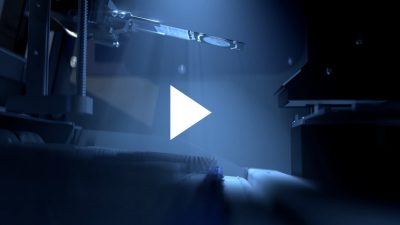 Hur AI och digital cytologi kan bidra i den globala kampen för att utrota död i livmoderhalscancer