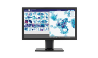 Digital cytologi med AI – snabbare och bättre