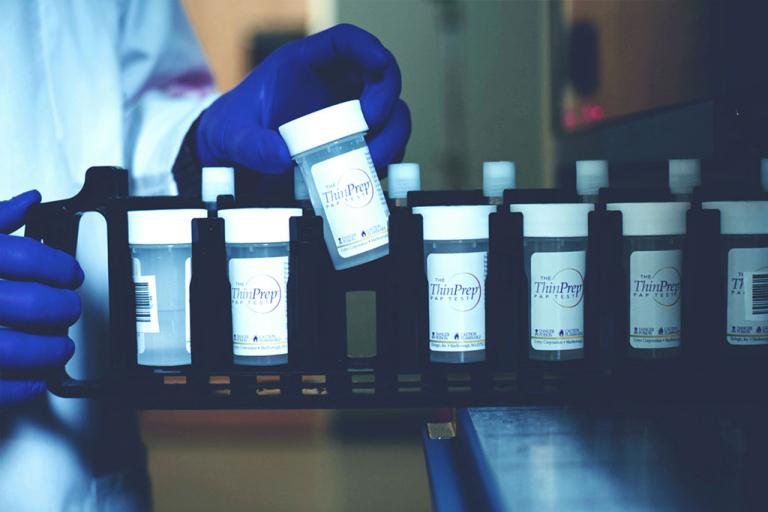 Behandskad hand tar ut prov ur bricka