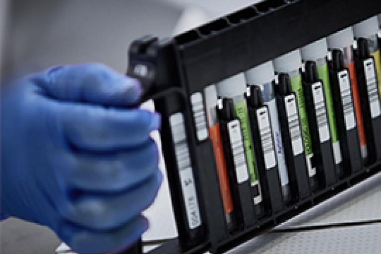 Handskbeklädd hand som håller i ställ med provburkar