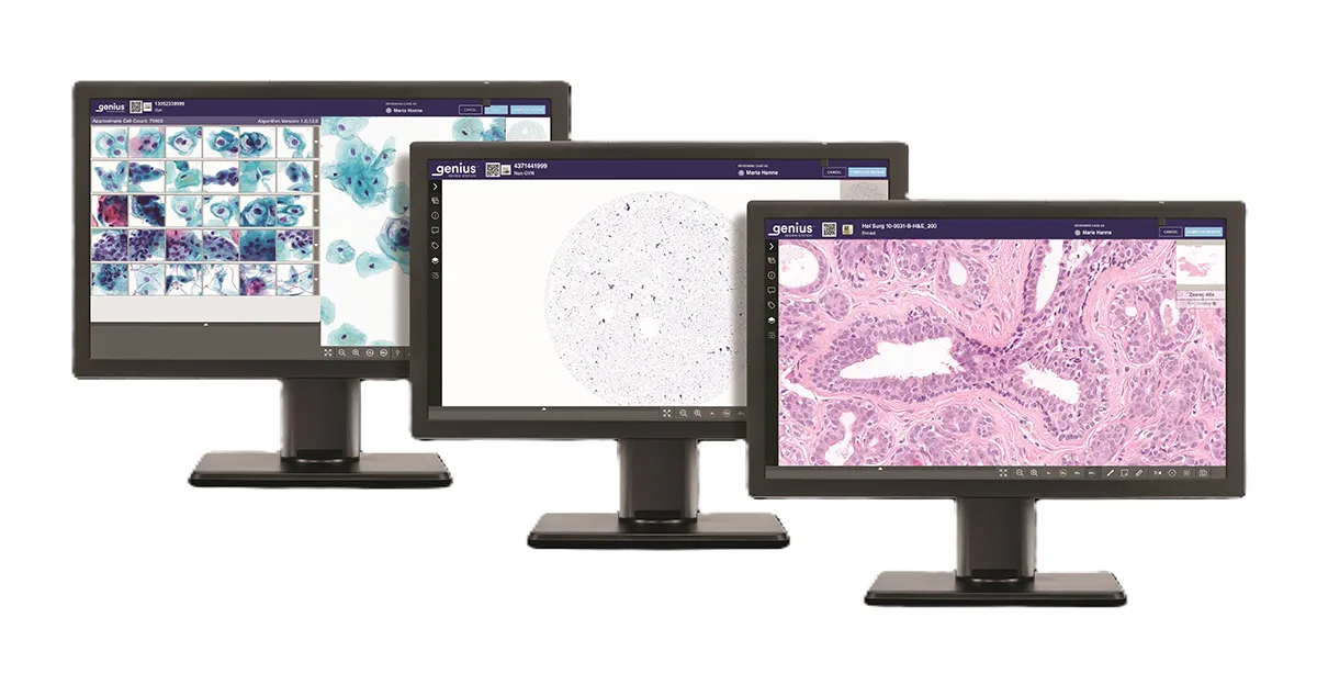 Genius Review-station som visar olika typer av prover (gynekologiska, icke-gynekologiska och histologiska).
