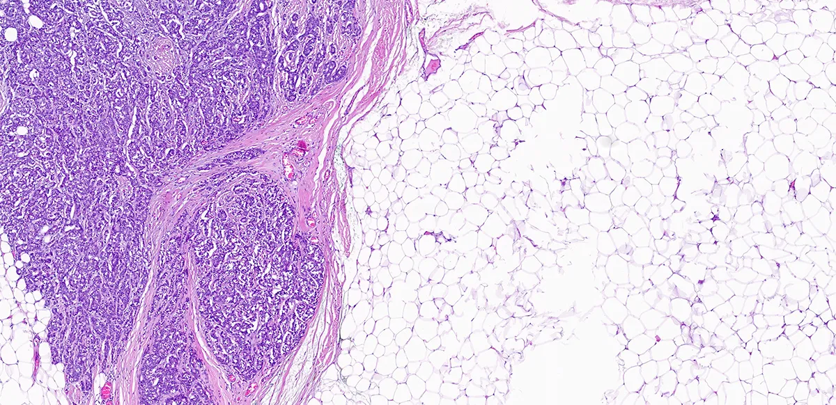 Image of fatty tissue