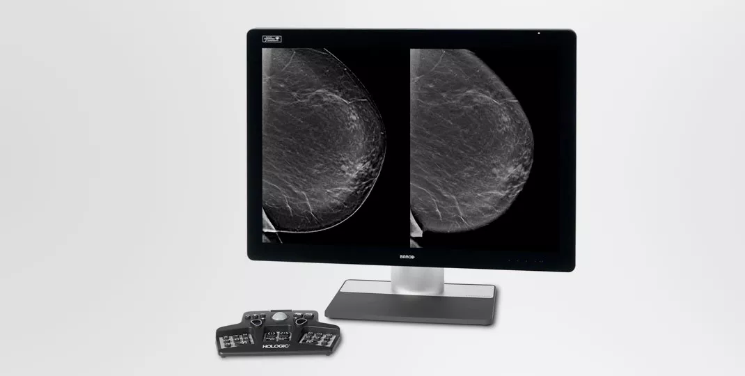 Röntgenbild av bröst