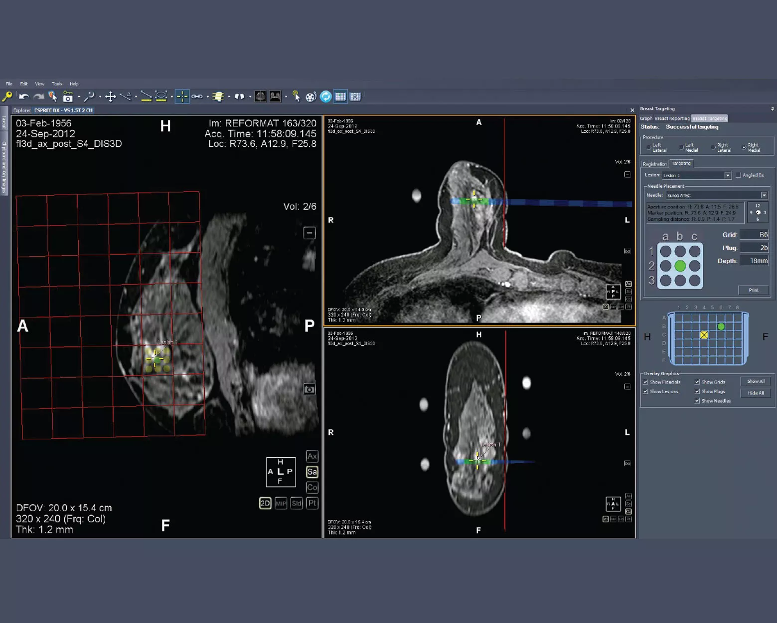 Skärmdump av MultiView