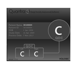 Hologic Quantra™ Technology mot vit bakgrund