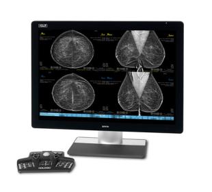 Hologic SecurView® Breast Imaging Workstation mot vit bakgrund